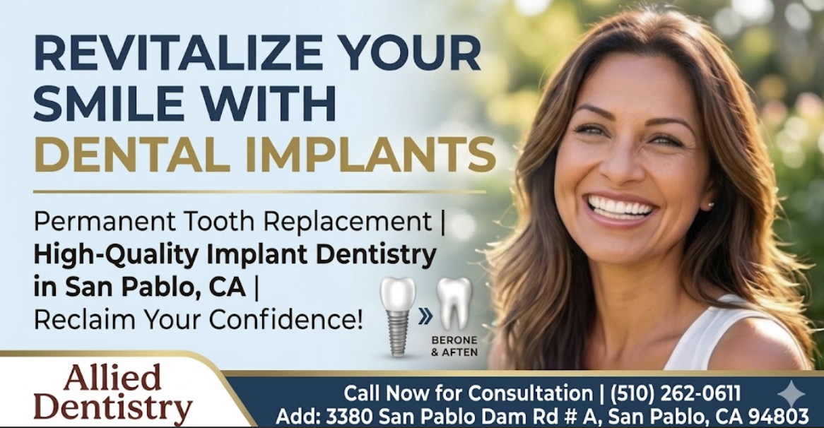 Dental Implants: Dental Implants & Emergency Dentist San Pablo CA | Tooth Replacement | Allied Dentistry